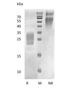 Recombinant Human Placental Growth Hormone