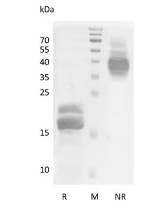 Recombinant Human Vascular Endothelial Growth Factor B