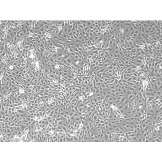 小鼠肾近端小管上皮细胞（MRPTEpiC）——相差显微镜下，100×