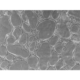 Cells day 4 of assay, 100x (day 4 cond1-10x)
