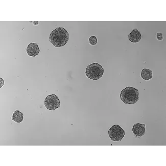 At days 3, 3D chondrocyte spheroid taken at 100X magnification.
