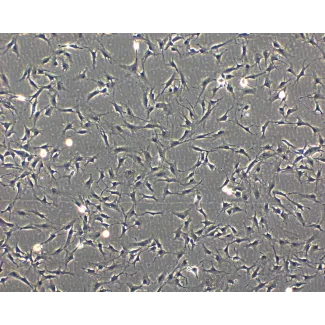 Phase Contrast Caption: Bovine Astrocytes (BA)- Phase Contrast, 100x

