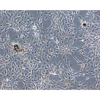 Bovine Iris Pigment Epithelial Cells (BIPEpiC)-Phase Contrast, 100X