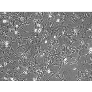 C57BL/6 小鼠小脑星形胶质细胞（MA-c）— 相差显微镜图像，100 倍放大
