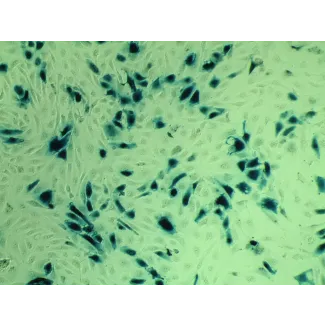 Transfections-EndoF