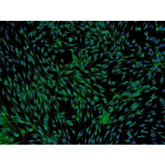 Human Adipose-derived Mesenchymal Stem Cells (HMSC-ad) - Immunostaining for CD73, 100x.