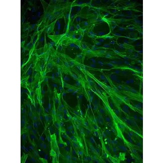 Human Aortic Smooth Muscle Cells (HASMC) - Immunostaining for α-SMA, 200x.
