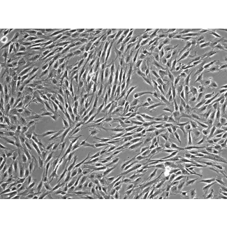 HumanBone Marrow-derived_Mesenchymal_Stem_Cells (HMSC-bm) – Phase contrast, 100x.
