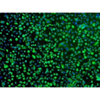 Human Bronchial Epithelial Cells (HBEpiC) - Immunostaining for CK-18, 100x.
