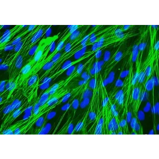 Human Bronchial Smooth Muscle Cells (HBSM) - Immunostaining for α-sma, 400x.
