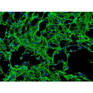 Human Calvarial Osteoblasts (HCO) - Immunostaining for Fibronectin, 200x.
