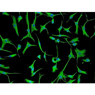Human Cardiac Fibroblasts-adult (HCF-a) - Immunostaining for Vimentin, 200x.
