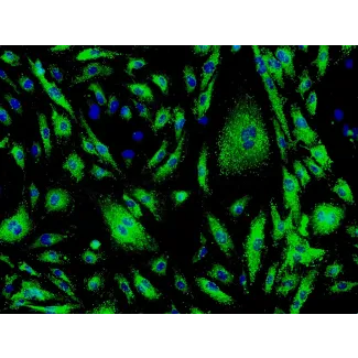 Human Cardiac Microvascular Endothelial Cells (HCMEC) - Immunostaining for vWF, 200x.
