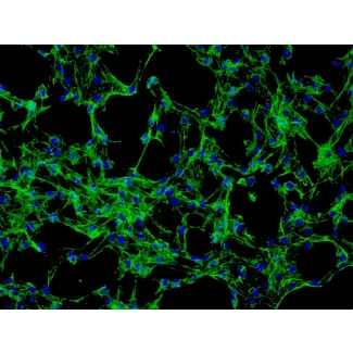 Human_Dermal_Fibroblasts-adult (HDF-a) - Immunostaining for Fibronectin, 200x.
