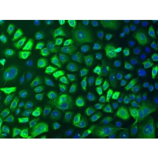 Human Epidermal Keratinocytes-adult (HEK-a) - Immunostaining for CK-18, 100x.
