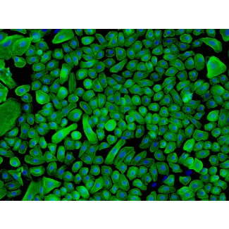 Human Epidermal Keratinocytes-neonatal (HEK-n) - Immunostaining for CK-18, 200x.
