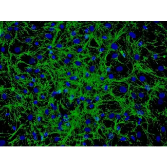 Human Hair Germinal Matrix Cells (HHGMC) - Immunostaining for Fibronectin, 200x.
