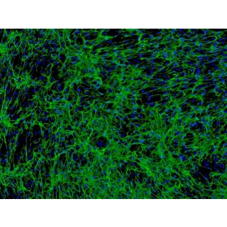Human Hair Outer Root Sheath Cells (HHORSC) - Immunostaining for Fibronectin, 100x.
