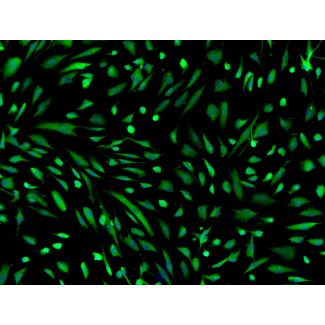 Human induced Pluripotent Stem Cell-derived Astrocytes - Immunostaining for GFAP, 100x