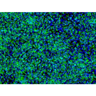 HiPSC-Derived Neural Stem Cells (HiPSC-NSC) - Immunostaining for Nestin, 200x
