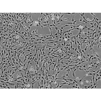 Human Liver-derived Mesenchymal Stem Cells (HMSC-he) - Phase contrast, 100x.

