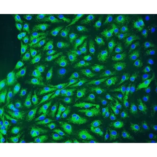 Human Lymphatic Endothelial Cells (HLEC) - Immunostaining for vWF, 200x.
