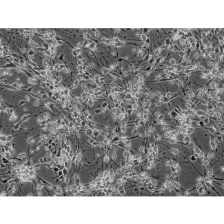 Human Neurons-midbrain (HN-mb) - Phase contrast, 200x.
