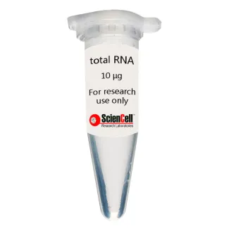 Human Ovarian Surface Epithelial Cell Total RNA