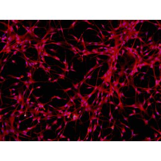 Human Pluripotent Stem Cell-derived Astrocytes - Immunostaining for GFAP, 100x