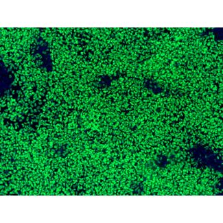 hPSC-Derived Neural Crest Cells (hPSC-NCC) - Immunostaining for SOX10, 100x