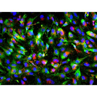 Human Pluripotent Stem Cell derived-Pericytes, immunostained for NG2 (green) and PDGFRβ (red) 200X
