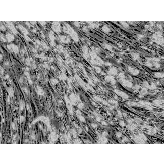 Intracellular lipid droplets are visible after differentiation, 400x.