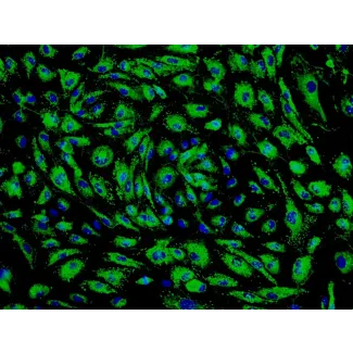 Human Pulmonary Microvascular Endothelial Cells (HPMEC) - Immunostaining for vWF, 200x.
