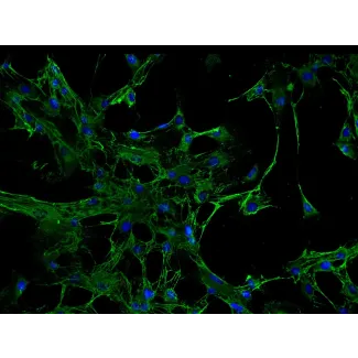 Human Renal Mesangial Cells (HRMC) - Immunostaining for Fibronectin, 200x.