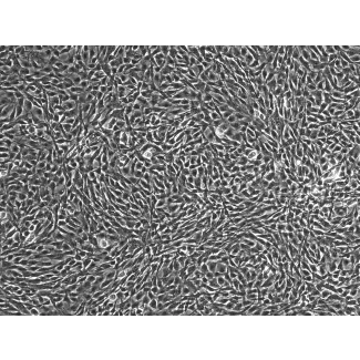 HUMAN SKELETAL MUSCLE MYOBLASTS (HSkMM)- phase contrast 100X
