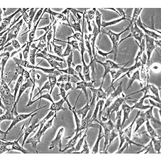 Human Skeletal Muscle Satellite Cells (HSkMSC) - Phase contrast, 200x.
