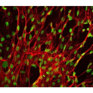 Human Splenic Fibroblasts (HSF) - Immunostaining for Fibronectin, 400x.
