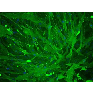 Human Umbillical Artery Smooth Muscle Cells (HUASMC) - Immunostaining for α-SMA, 200x.

