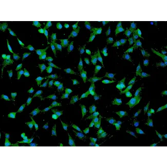 Human Umbilical Mesenchymal Stem Cells (HUMSC) - Immunostaining for CD73, 200x.
