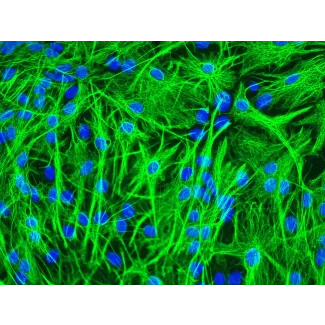 Mouse Astrocytes (MA) - Immunostaining for GFAP, 200x.
