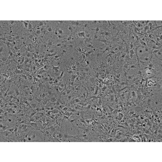 Mouse Cardiac Myocytes (MCF) - Phase contrast, 100x.