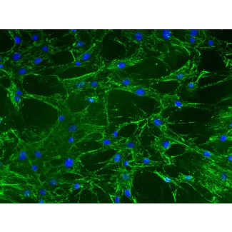 Mouse Lymphatic Fibroblasts (MLF) – Immunostaining for Fibronectin, 200x
