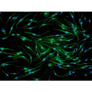 Mouse Macrophages-bone marrow (MMa-bm) - Immunostaining for CD11b, 200x.
