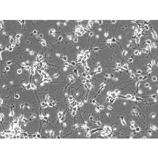 Mouse Neurons-cortical (MN-c) - Phase contrast, 200x.
