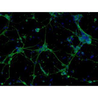 Mouse Neurons-forebrain (MN-fb)-Immunostaining for b-tubulin III, 200X