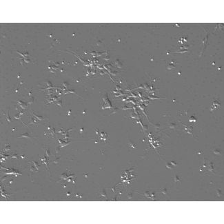Mouse Neurons-midbrain (MN-mb)-Phase Contrast, 100X
