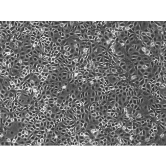 Mouse Pulmonary Alveolar Epithelial Cells (MPAEpiC) - Phase contrast, 100x
