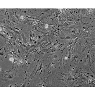 Mouse Renal Mesangial Cells (MRMC) - Phase contrast, 100x.
