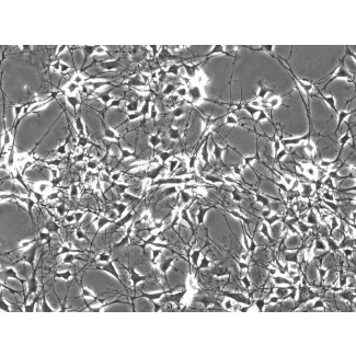 Mouse Schwann Cells (MSC) - Phase contrast, 200x.
