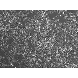 Mouse Splenic Macrophages (MSMa) – Phase Contrast, 200x
